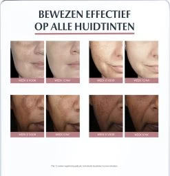 Eucerin Anti-Pigment Spotcorrector - Concealer - 5 Ml -Cosmeticawinkel 1157x1200 1