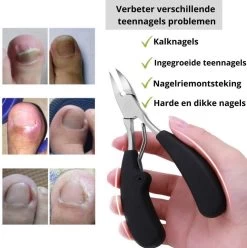Merkloos Nageltang Voor Harde Teennagels - Manicureset Teennagelknipper - Teennagelschaar - Pedicure Set -Cosmeticawinkel 1196x1200 11