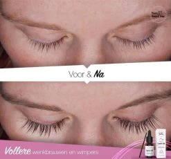 Your Beauty Tree ® Wimper Serum Met Echte Castor Olie |100% Natuurlijke Wimpergroei| Castor Oil Eyelash Serum|Wonder Olie | Wimper Groei | Wenkbrauw Serum | Lash Serum | Wimper Groeimiddel -Cosmeticawinkel 1200x1115 5
