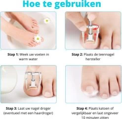 XYZ Goods - 7-delige Manicure Set - Speciaal Voor Ingegroeide Teennagel En Kalknagel - Inclusief Etui -Cosmeticawinkel 1200x1169 2