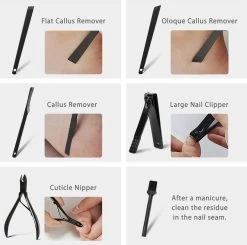 Nagelknipper Set - Pedicureset - 15 Delige - Roestvrij Staal - Met Draagkoffer - Geel Zwart -Cosmeticawinkel 1200x1192 5