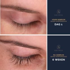 Skines® Wimperserum Premium – Eyelash Serum - Wenkbrauw Serum - Wimper Groei - 3ML -Cosmeticawinkel 1200x1200 1358