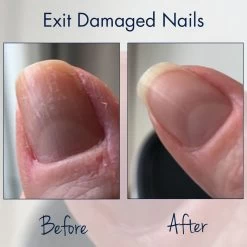 Herome Combi-Pack Exit Damaged Nails & Nagelverharder Extra Sterk (Nail Hardener Extra Strong) - Herstelt Beschadigde Nagels En Zorgt Voor Ijzersterke Nagels - 7ml. & 10ml. -Cosmeticawinkel 1200x1200 184