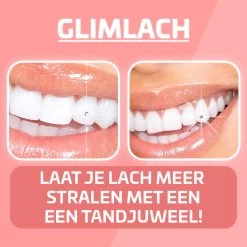 Nince DIY Tooth Gem Kit Hoogwaardig Materiaal - Wit - Tand Diamantje Kit -Cosmeticawinkel 1200x1200 40