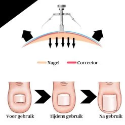 Merkloos STARMAN 7-delige Pedicure En Manicure Set - Nagelknipper - Pedicureset - Nagelvijl - Nageltang - Kalknagel - Teennagelknipper 16 Merkloos STARMAN 7-delige Pedicure En Manicure Set - Nagelknipper - Pedicureset - Nagelvijl - Nageltang - Kalknagel - Teennagelknipper -Cosmeticawinkel 1200x1200 623