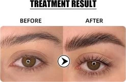 Flora Ruby - Wimper & Wenkbrauw Lifting Set 2 In 1 - Professionele 2 In 1 Lash Lift & Brow Lamination Kit - Permanente Wimperkruller -Cosmeticawinkel 1200x782 2