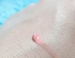 Biodermal Sun Lipbalm SPF25 - Tube 12 Ml - Natural Pink - Lippenbalsem 9 Biodermal Sun Lipbalm SPF25 - Tube 12 Ml - Natural Pink - Lippenbalsem -Cosmeticawinkel 1200x927 2