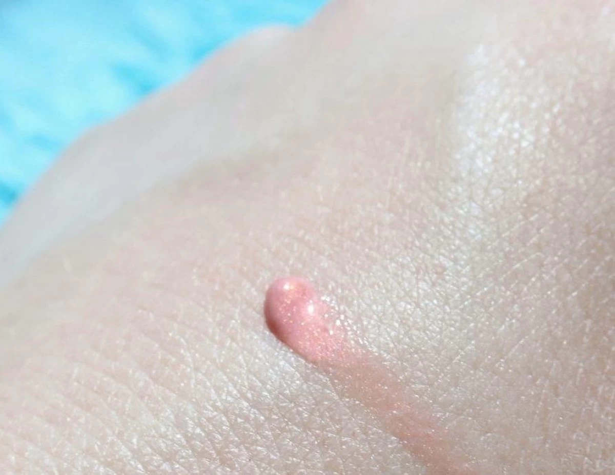 Biodermal Sun Lipbalm SPF25 - Tube 12 Ml - Natural Pink - Lippenbalsem 6 Biodermal Sun Lipbalm SPF25 - Tube 12 Ml - Natural Pink - Lippenbalsem - Afbeelding 4